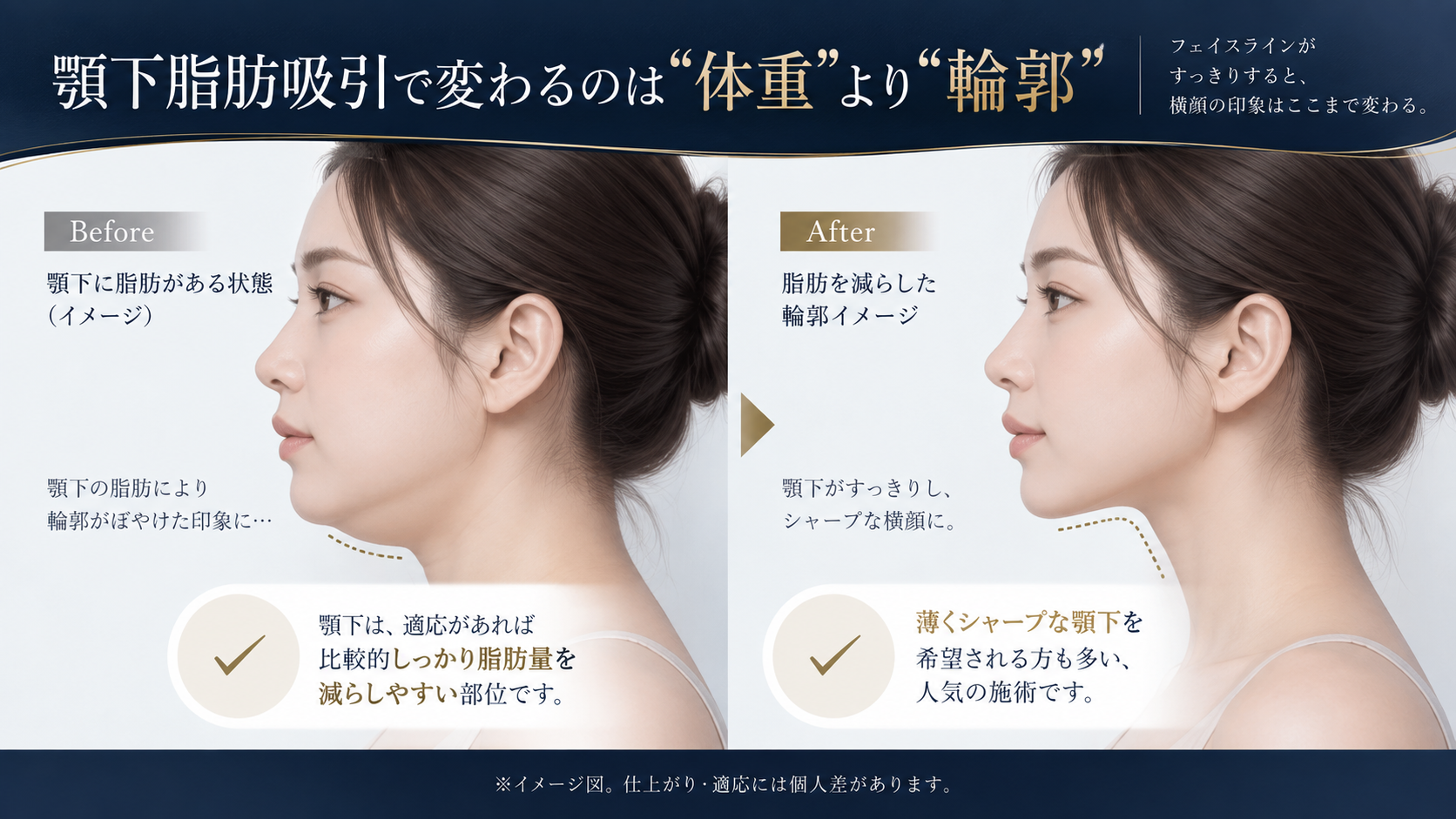 顎下脂肪吸引で変わるのは体重より輪郭というイメージ図