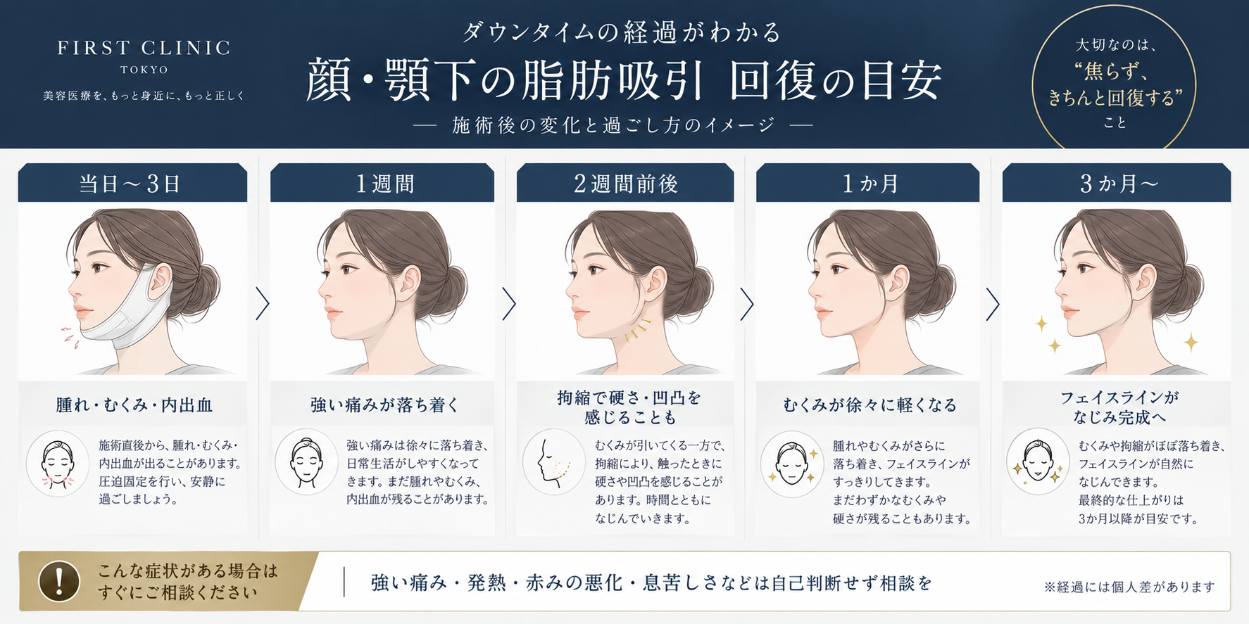 顔・顎下の脂肪吸引後のダウンタイム経過目安