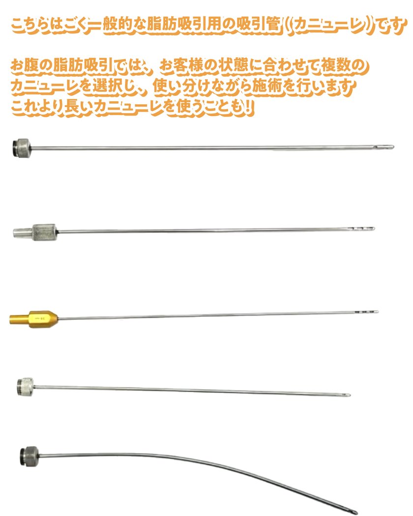 松田_腹_カニューレ