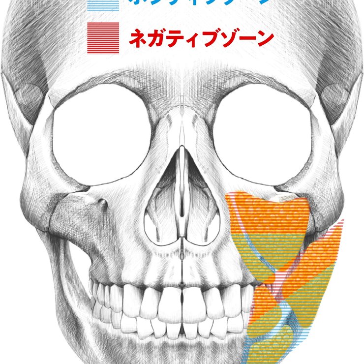 【顔の脂肪吸引】どこを取ってどこを残す？老け見えを防ぐ脂肪の取り方を美容外科医が解説