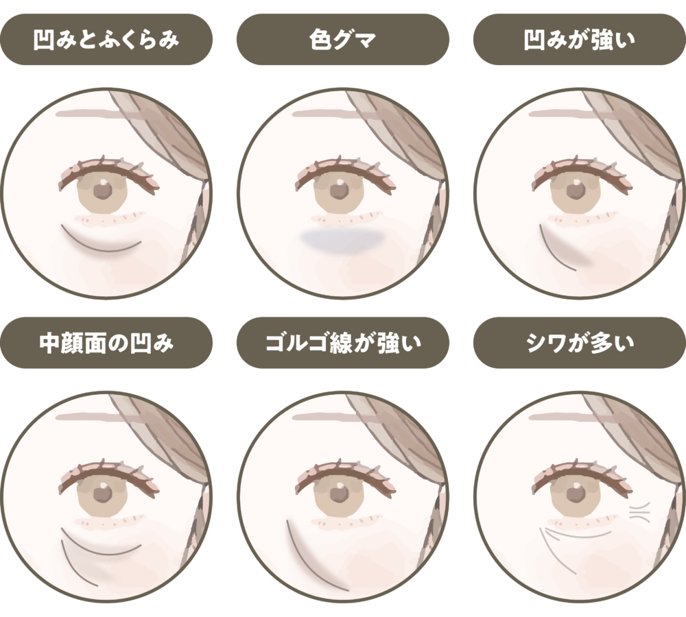 松田医師による目元施術の症例写真