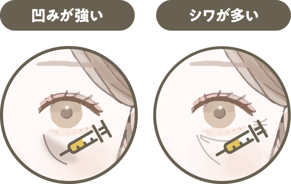 松田医師による目元施術の症例写真