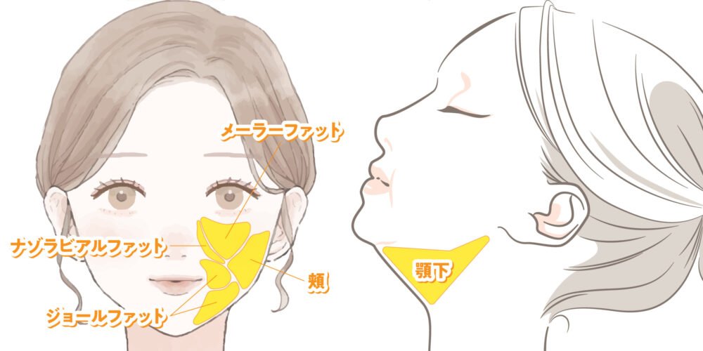 LSSA（エルサ）の解説図