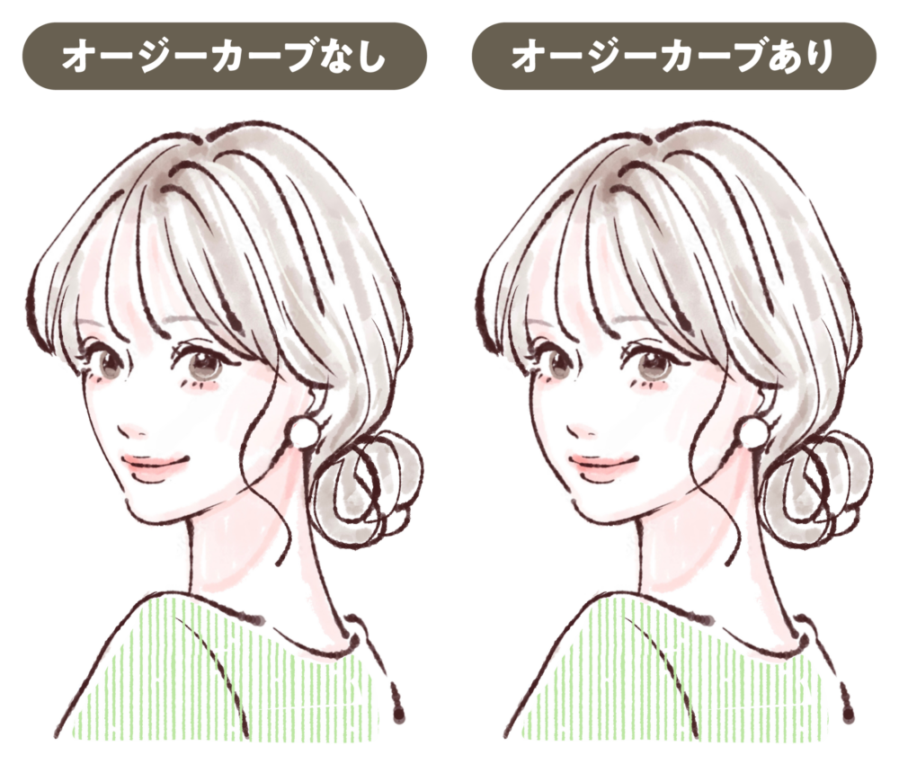 松田医師による目元施術の症例写真