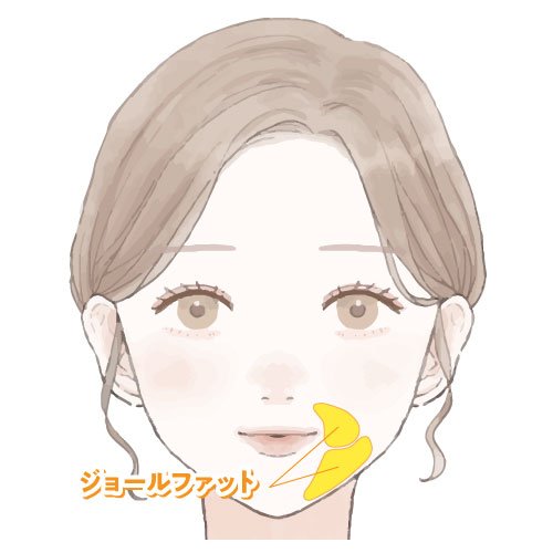 ジョールファットの位置イラスト