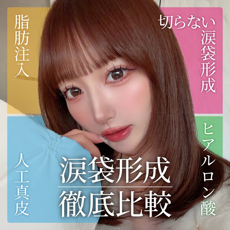 【涙袋形成】涙袋が欲しい方！ヒアルロン酸・脂肪注入・切らない涙袋形成・人工真皮を目元整形の名医 松田医師が徹底比較！