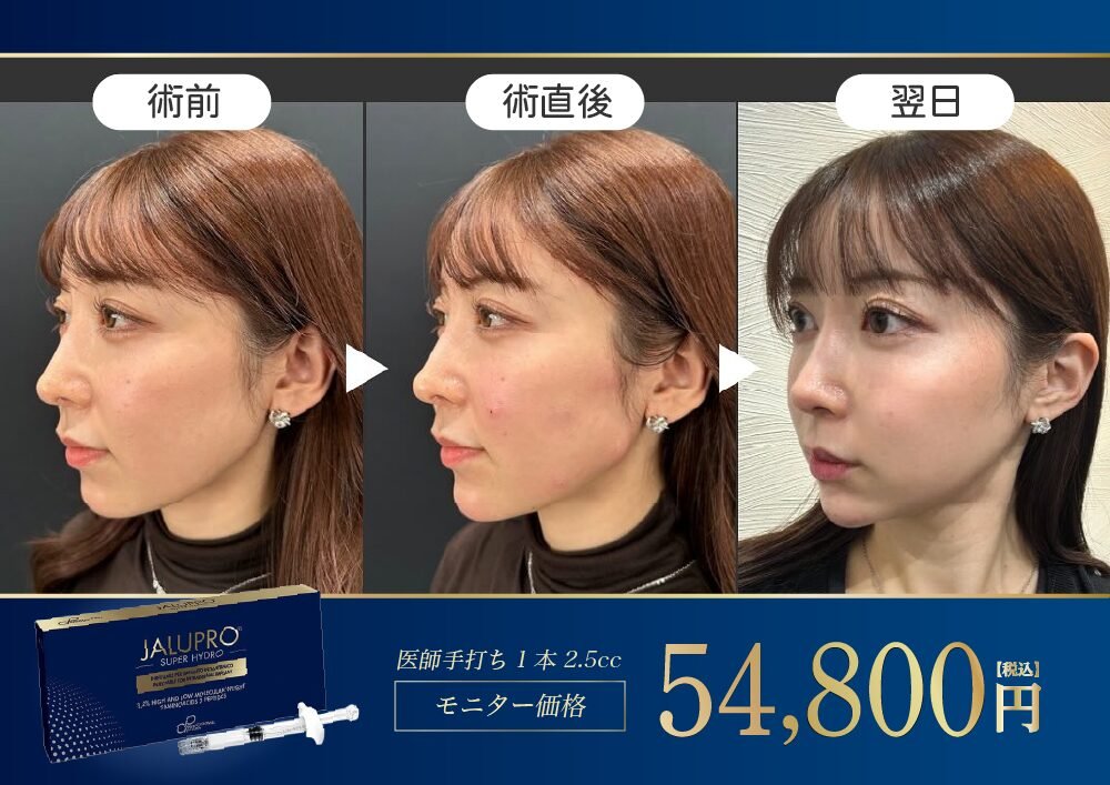 ジャルプロの解説画像