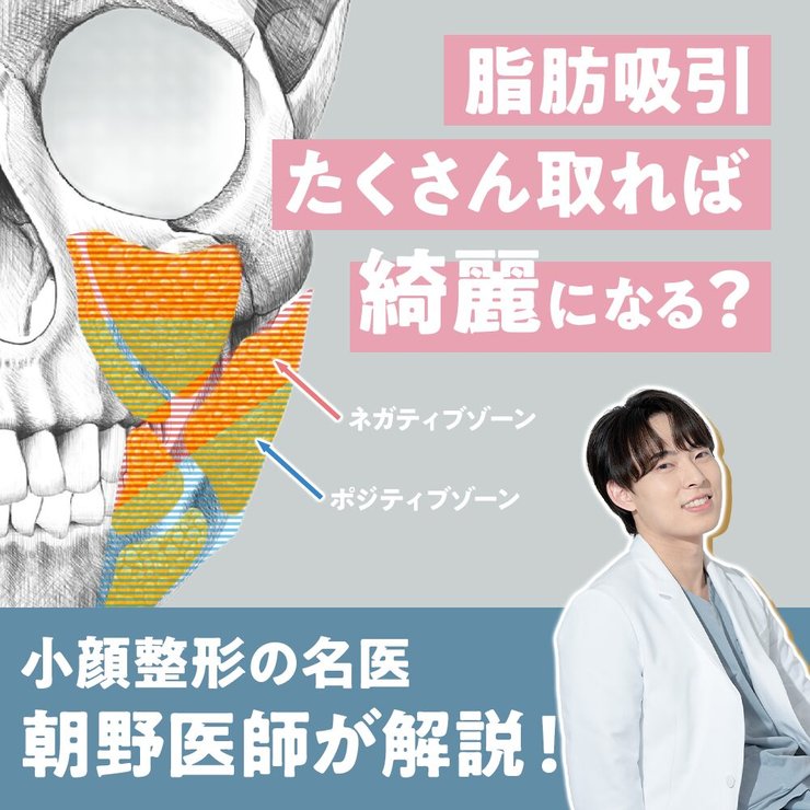 【脂肪吸引 ＝ たくさん取れば小顔になる、は嘘】名医がこだわる「脂肪配置のバランス」