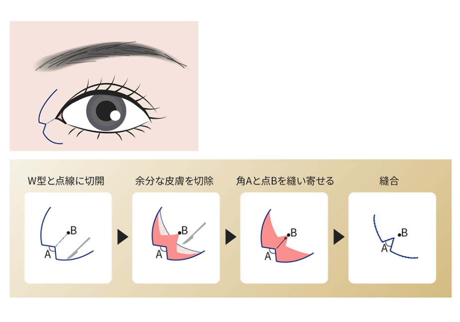 menu03_ph16-1000x646
