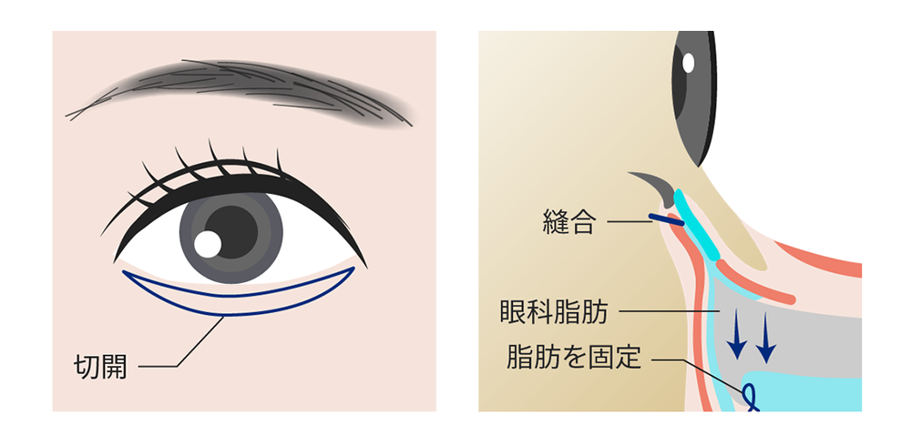 menu12_ph09