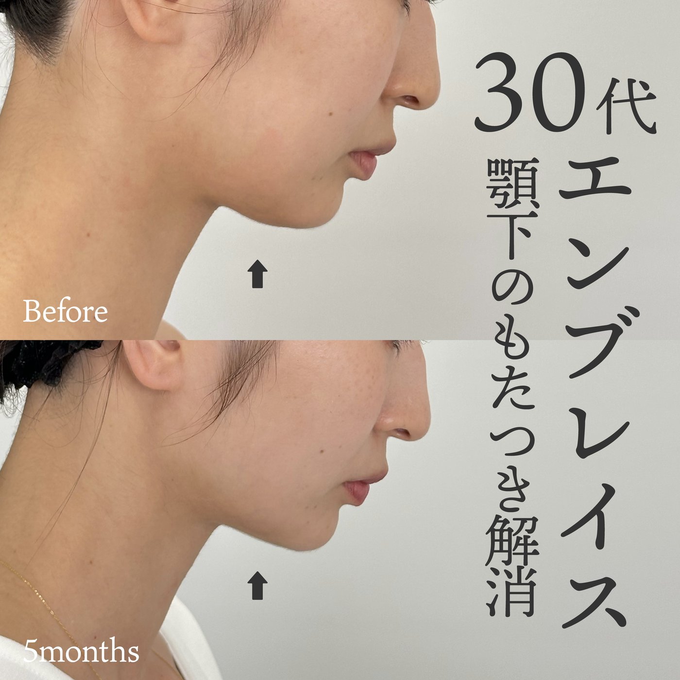 30代女性　エンブレイス
