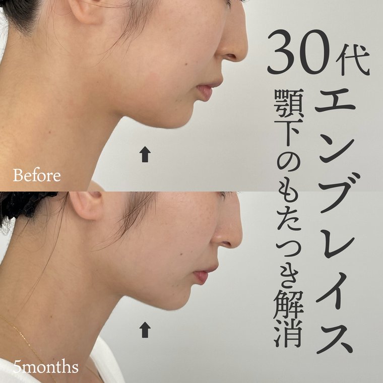 30代女性　エンブレイス
