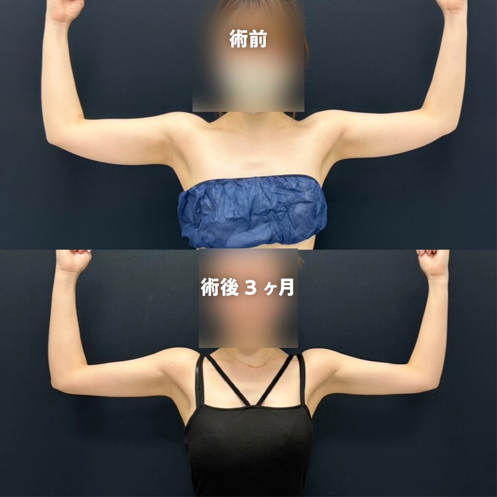 症例-03（復元・旧HP）