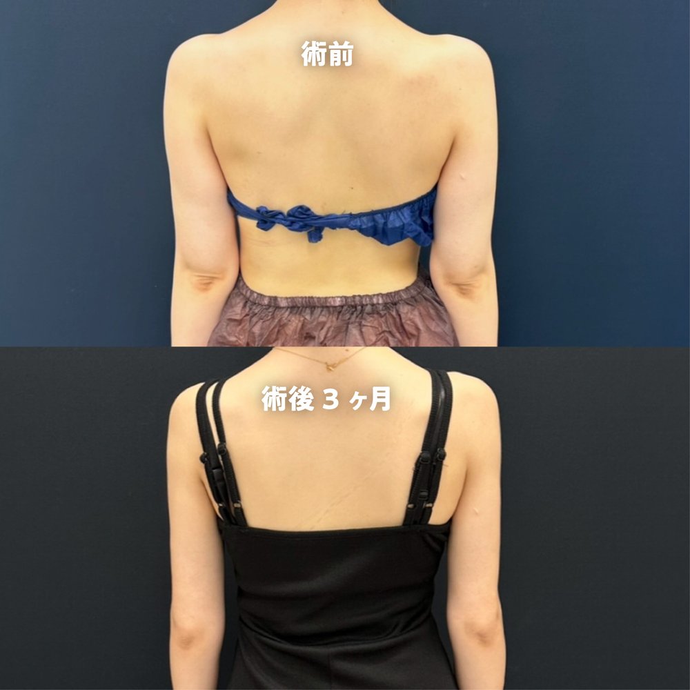 症例-04（復元・旧HP）