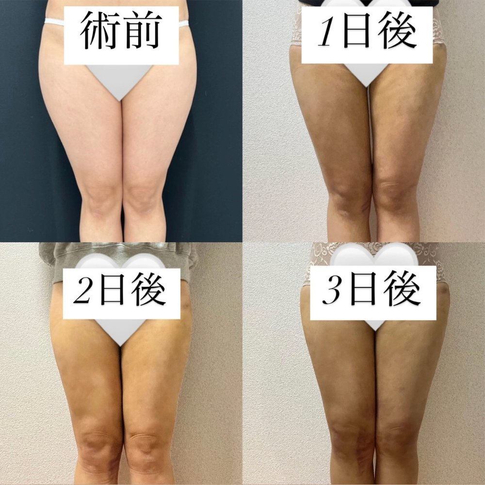 症例ダウンタイム-07（復元・旧HP）